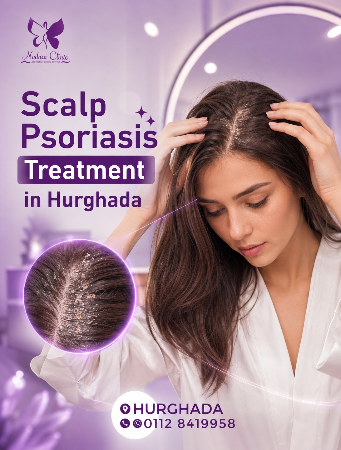 Hair psoriasis treatment in Hurghada